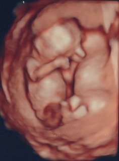 05--04s